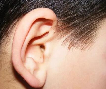 耳再造手术有哪些方法_耳再造手术有哪些专家最好