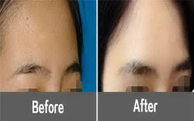 纹眉纹眼线多久可以化妆「纹眉纹眼线多久可以正常护肤」