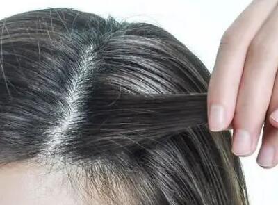 防止化疗脱发的方法「怎样防止化疗脱发方法」