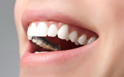 牙龈肿出血是什么原因(牙龈无故出血是什么原因)