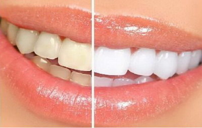 口腔颌面外科可以矫正牙齿吗?