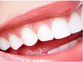 国产牙种植体质量如何