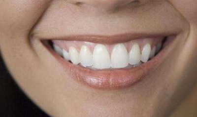 激光美白牙齿副作用「冷激光美白牙齿副作用」