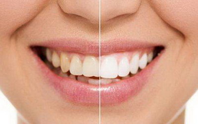 牙龈萎缩怎么治疗与日常保养