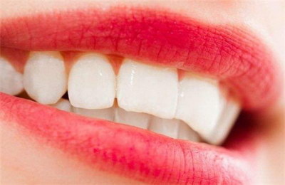 贵州人的黄牙齿能洗白吗