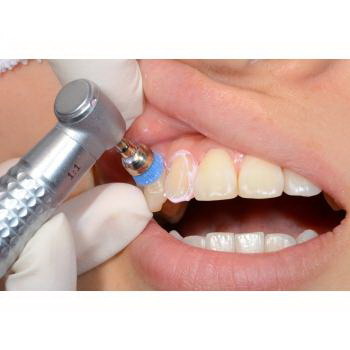 根管治疗牙齿填充物含增塑剂吗?