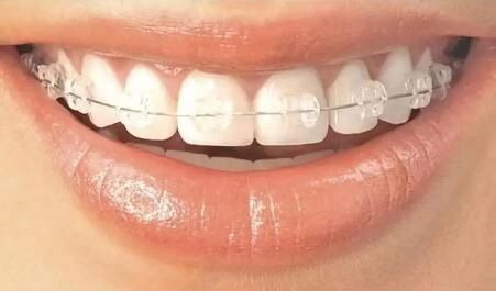 牙龈瘘管牙齿松动_拔掉的牙齿可以做种植牙吗