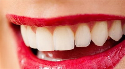 美容冠可以矫正骨性龅牙吗(什么是美容冠？)