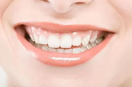 正畸牙齿的流程与必要性_牙齿缺失最晚多久做种植牙