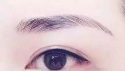 韩式双眼皮能不能给你一双美丽的大眼睛？