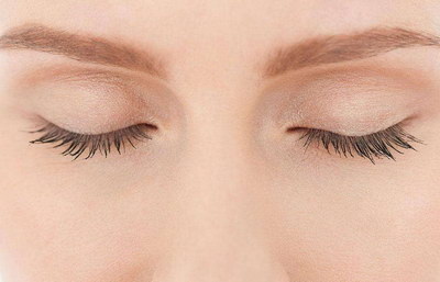 埋线双眼皮手术多久可以恢复完美？