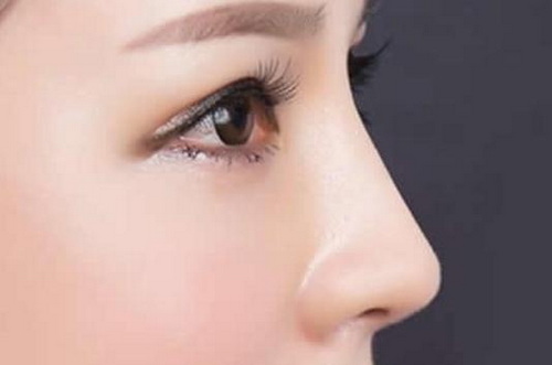眼睛好看鼻子不好看的人适合刘海吗_适用于什么样的鼻子的鼻翼缩小手术?