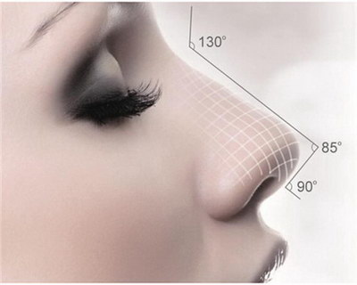 垫鼻尖恢复期是多久_垫鼻尖会影响生活吗