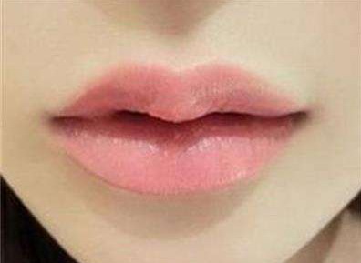 玻尿酸丰唇多久消肿要肿多久呢？
