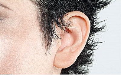 附耳是谁的基因影响的(什么是附耳？)