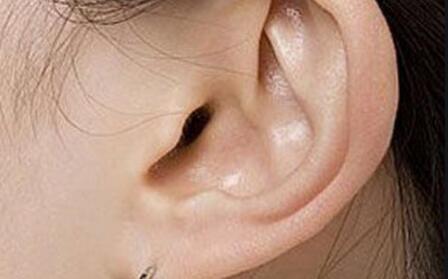 耳朵畸形整形价格表(耳朵畸形手术价格表)