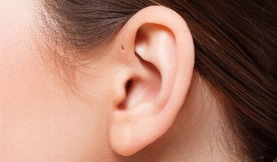 做小耳畸形手术是不是都会留疤啊