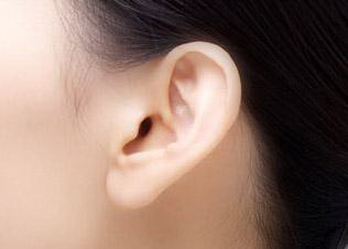 杯状耳需要耳廓再造吗(是的，杯状耳需要耳廓再造)