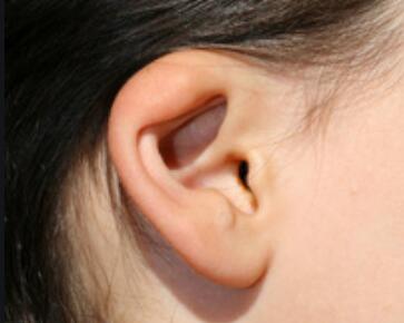 耳朵下面的脖子是什么部位【为什么耳朵下面的脖子上长了个硬包】