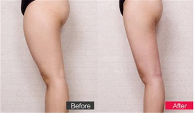 减肥瘦臀部大腿方法运动有哪些