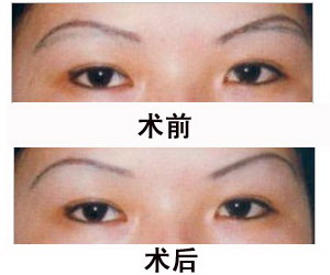 眉毛怎么修复的_眉毛修复剂的作用是什么