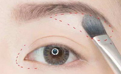 眉毛移植术的优势与术后护理。