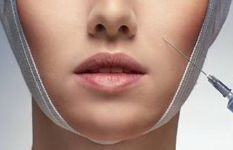 线雕后多久可以洗脸洗头_线雕鼻的副作用和危害