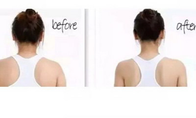 肩膀厚是什么原因造成的怎么减(背部肩膀长痘是什么原因)