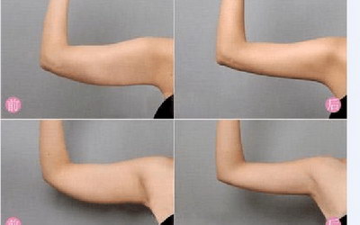 快速瘦手臂和背部的快速方法(怎样快速瘦手臂和背部肉)