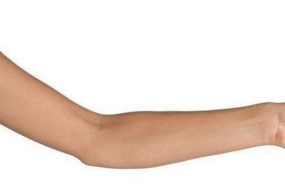 手臂抽脂什么时候能看得到效果_手臂抽脂术后注意事项