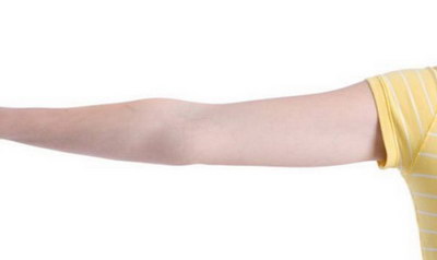 手臂抽脂皮肤会变松垮吗？