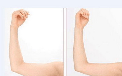 如何快速瘦手臂：有效的运动和饮食建议