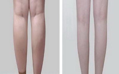 倒立大腿能瘦腿吗_减肥瘦臀部大腿方法运动有哪些