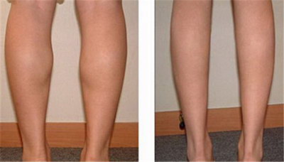 瘦腿最有效的动作趴着做_瘦腿的有效方法四个动作