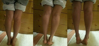 大腿减肥运动方法(大腿减肥运动方法)