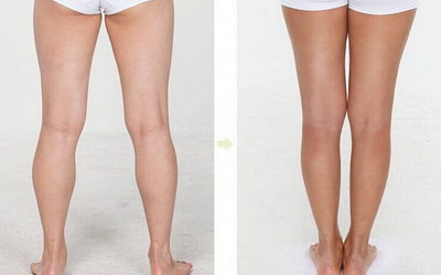快速瘦腿的方法「12岁女生快速瘦腿方法」