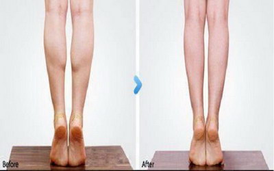 女人瘦腿有什么有效的方法吗？