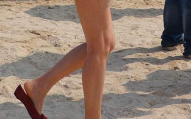 大腿内侧有一条一条红色的血丝_大腿内侧有一条一条紫色的像疤痕
