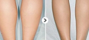 女性大腿怎么减肥最快
