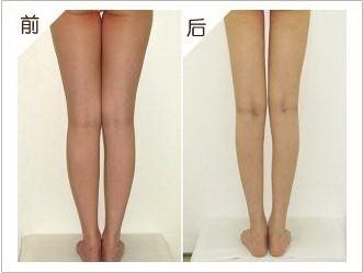 大腿减肥有效办法(大腿内侧减肥最有效的办法)