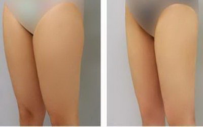 瘦小腿肚最有效的方法工具「瘦小腿肚最有效的拉伸方法」