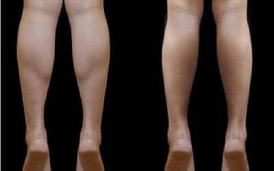 瘦大腿瘦屁股最有效最快速运动方法(瘦大腿瘦屁股最有效最快速的运动)