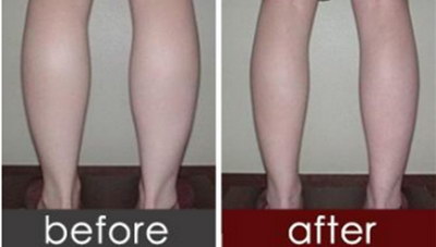 如何瘦大腿最有效方法有哪些？