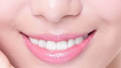 树脂渗透美白牙齿的副作用