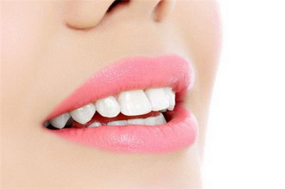 牙齿龅牙矫正治疗