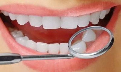 美容冠牙齿矫正是否会影响脸型