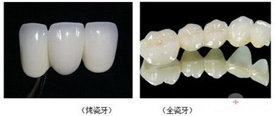 广州可以做正颌手术的医院_正规做正颌手术医院
