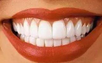 长沙牙齿龅牙(长沙牙齿的尴尬——龅牙问题)