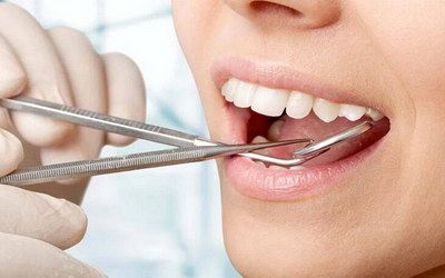 人正常有多少颗牙齿上下各多少(人类的牙齿构造)