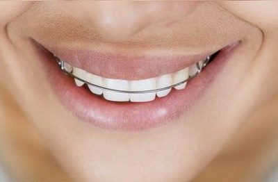 拔智齿对其他牙齿有影响吗?(拔智齿对其他牙齿有什么影响)